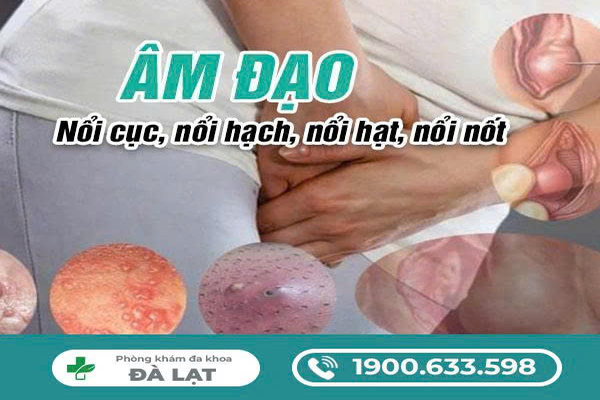 Hình ảnh minh họa